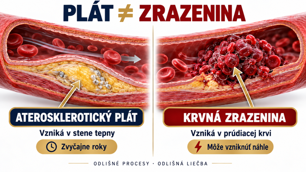 Schéma cévního plátu a sraženiny