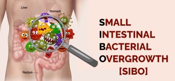 SIBO, SIFO a leaky gut syndrom (tzv. propustné či „děravé“ střevo)