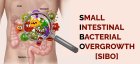 SIBO - SIFO - Leaky gut