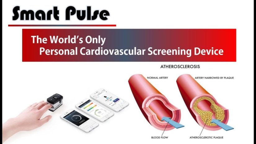 Smart Pulse pro domácí použití