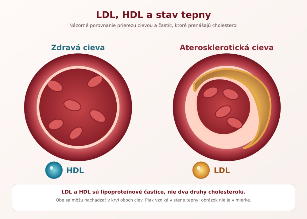 Názorné porovnání lipoproteinových částic LDL a HDL u cévy